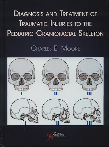 Portada del libro 9781597561402 Diagnosis and Treatment of Traumatic Injuries to the Pediatric Craniofacial Skeleton
