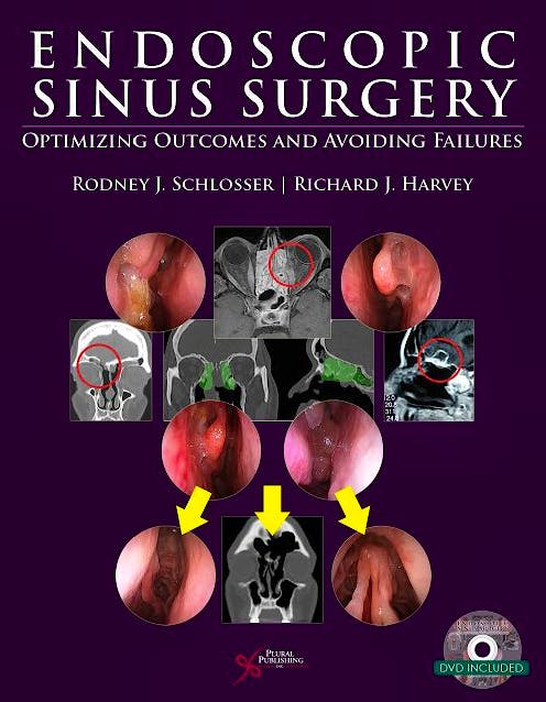 Portada del libro 9781597564304 Endoscopic Sinus Surgery. Optimizing Outcomes and Avoiding Failures