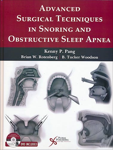 Portada del libro 9781597564717 Advanced Surgical Techniques in Snoring and Obstructive Sleep Apnea