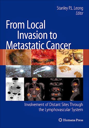 Portada del libro 9781603270861 From Local Invasion to Metastatic Cancer