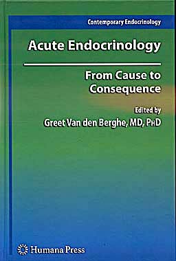 Portada del libro 9781603271769 Acute Endocrinology. from Cause to Consequence (Contemporary Endocrinology)