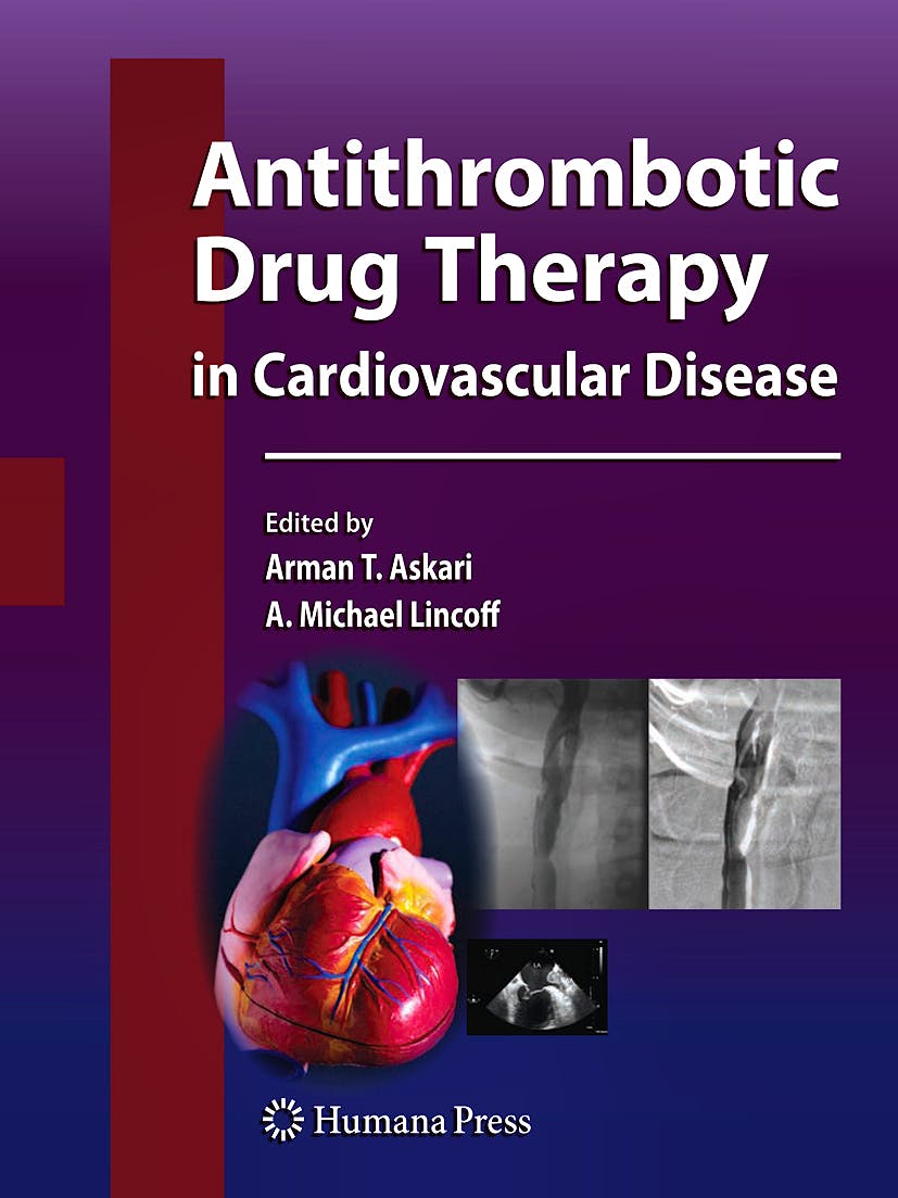 Portada del libro 9781603272346 Antithrombotic Drug Therapy in Cardiovascular Disease