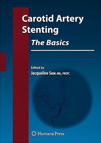 Portada del libro 9781603273138 Carotid Artery Stenting. the Basics