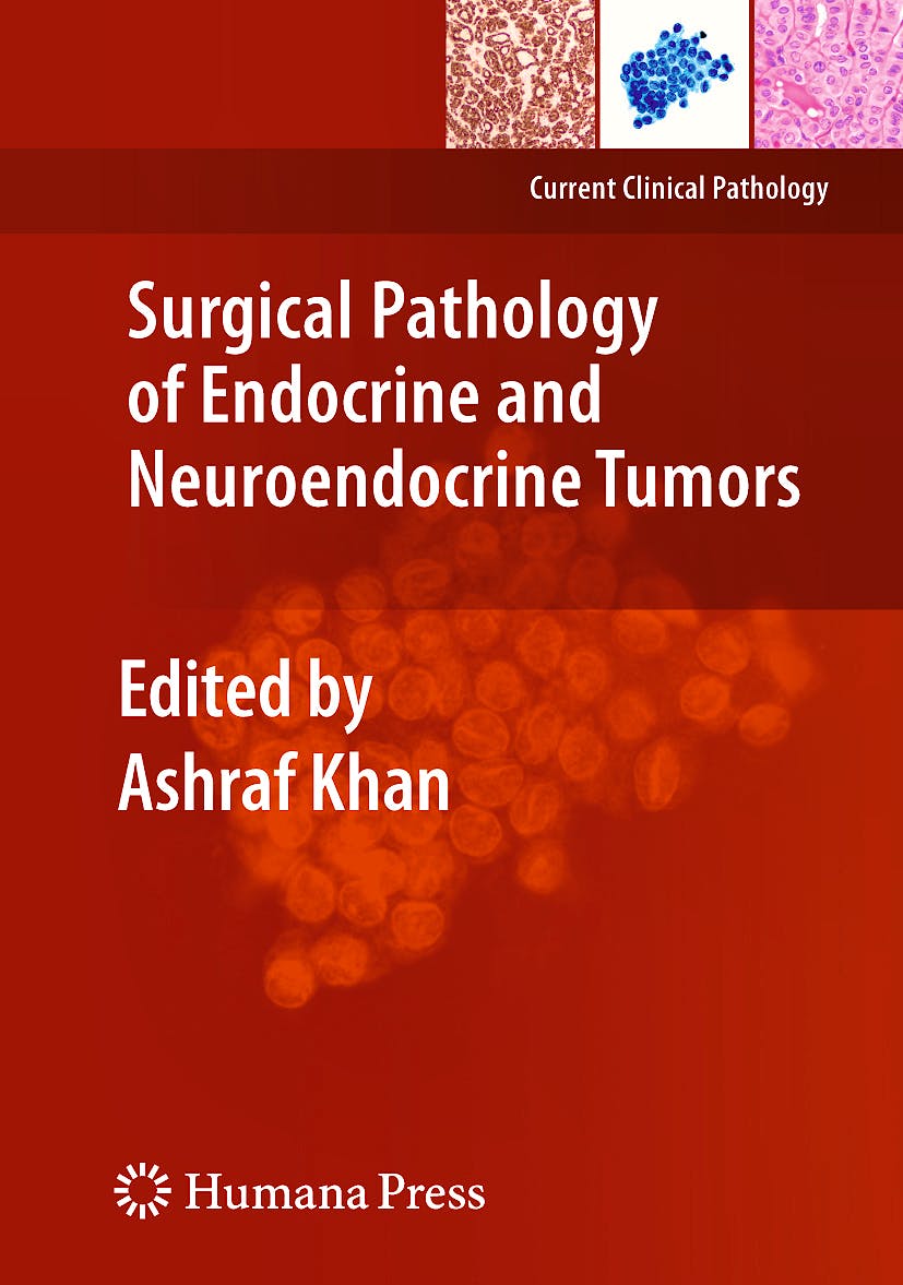 Portada del libro 9781603273954 Surgical Pathology of Endocrine and Neuroendocrine Tumors (Current Clinical Pathology)