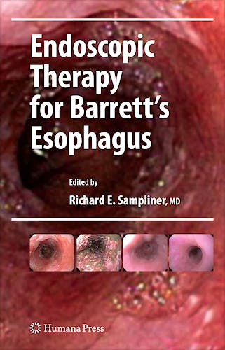 Portada del libro 9781603274449 Endoscopic Therapy for Barrett's Esophagus
