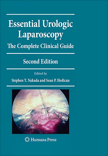Portada del libro 9781603278195 Essential Urologic Laparoscopy. the Complete Clinical Guide