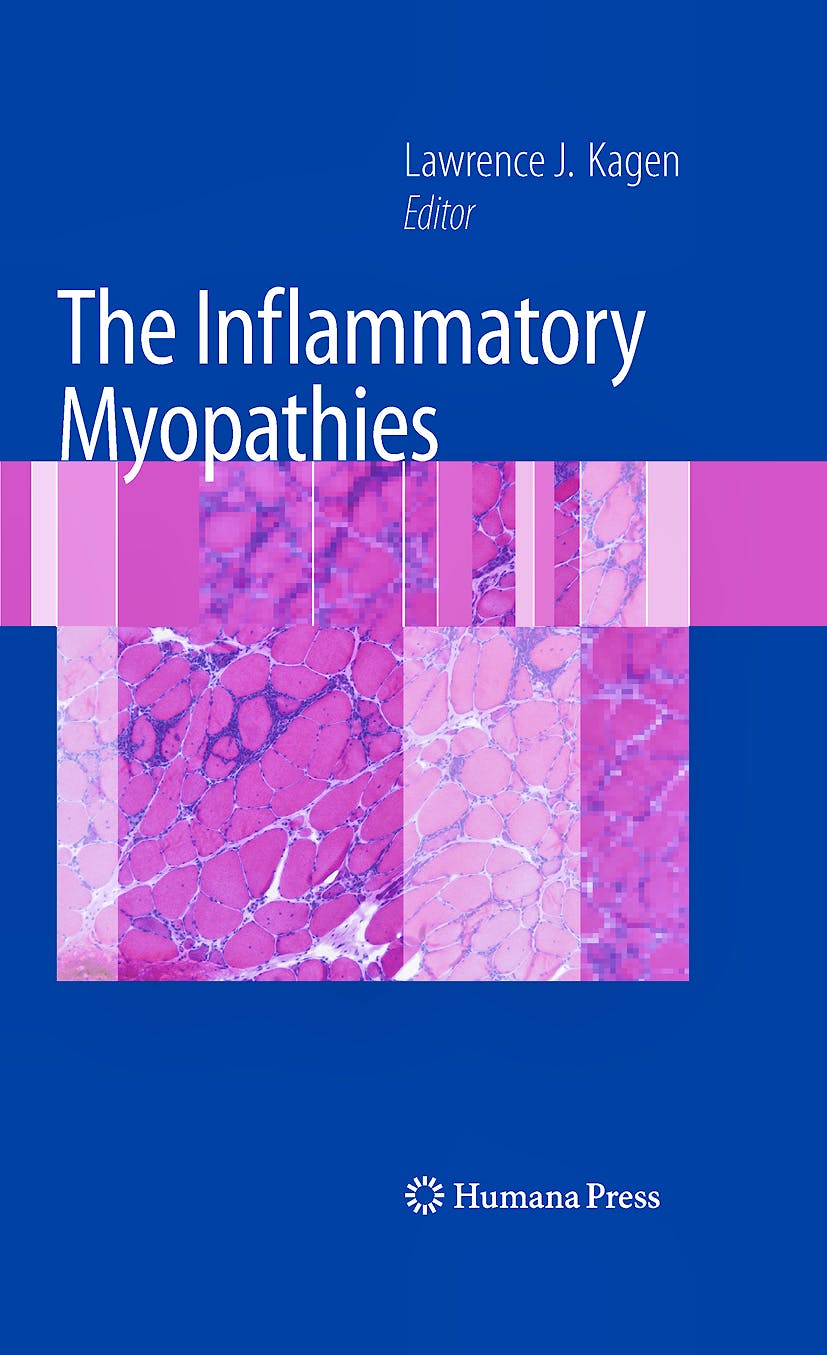 Portada del libro 9781603278287 The Inflammatory Myopathies