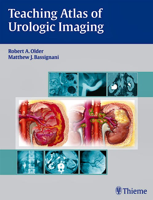 Portada del libro 9781604060164 Teaching Atlas of Urologic Imaging