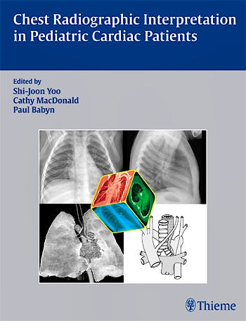 Portada del libro 9781604060362 Chest Radiographic Interpretation in Pediatric Cardiac Patients