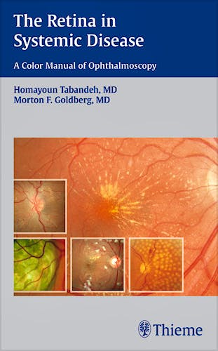 Portada del libro 9781604060553 The Retina in Systemic Disease. A Color Manual of Ophthalmoscopy