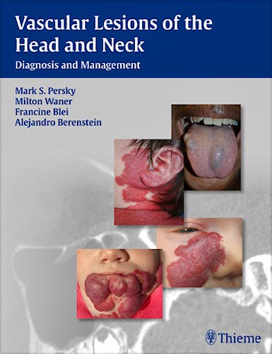 Portada del libro 9781604060591 Vascular Lesions of the Head and Neck. Diagnosis and Management