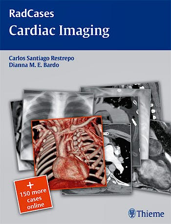 Portada del libro 9781604061857 Cardiac Imaging (Radcases Series) + 150 More Cases Online