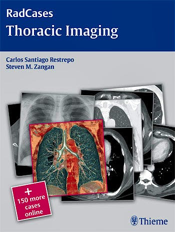 Portada del libro 9781604061871 Thoracic Imaging (Radcases Series) + 150 More Cases Online