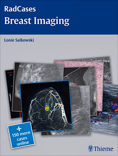 Portada del libro 9781604061918 Breast Imaging (Radcases Series) + 150 More Cases Online