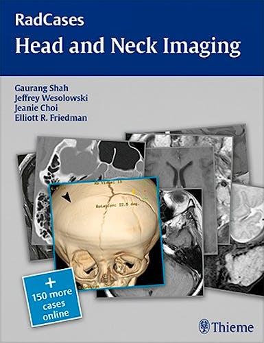Portada del libro 9781604061932 Head and Neck Imaging (Radcases Series) + 150 More Cases Online