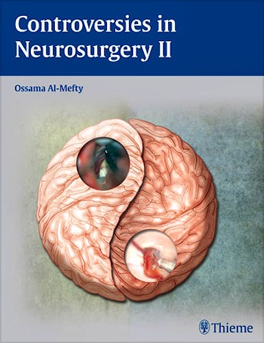 Portada del libro 9781604062328 Controversies in Neurosurgery II
