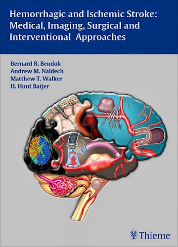 Portada del libro 9781604062342 Hemorrhagic and Ischemic Stroke. Medical, Imaging, Surgical and Interventional Approaches