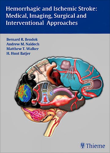 Portada del libro 9781604062342 Hemorrhagic and Ischemic Stroke. Medical, Imaging, Surgical and Interventional Approaches