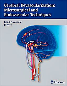 Portada del libro 9781604062632 Cerebral Revascularization: Microsurgical and Endovascular Techniques