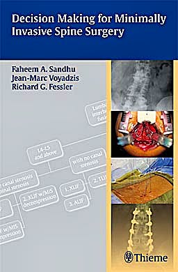 Portada del libro 9781604062663 Decision Making for Minimally Invasive Spine Surgery