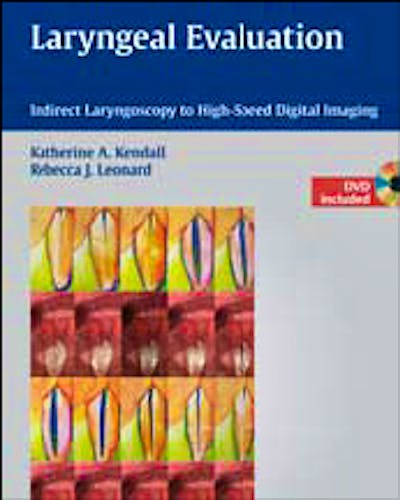Portada del libro 9781604062724 Laryngeal Evaluation. Indirect Laryngoscopy to High-Speed Digital Imaging