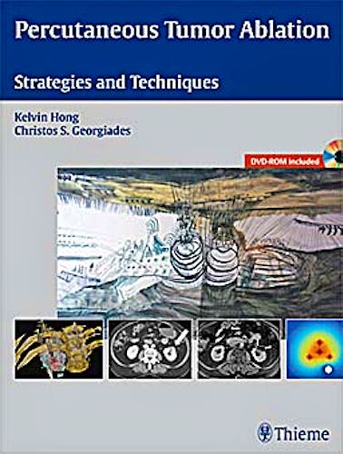Portada del libro 9781604063066 Percutaneous Tumor Ablation. Strategies and Techniques