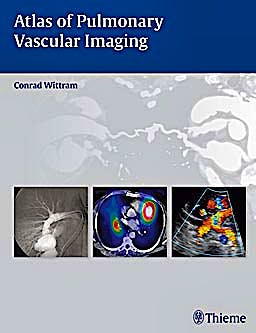 Portada del libro 9781604063127 Atlas of Pulmonary Vascular Imaging