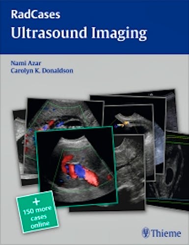 Portada del libro 9781604063226 Ultrasound Imaging. Radcases + 150 Cases Online
