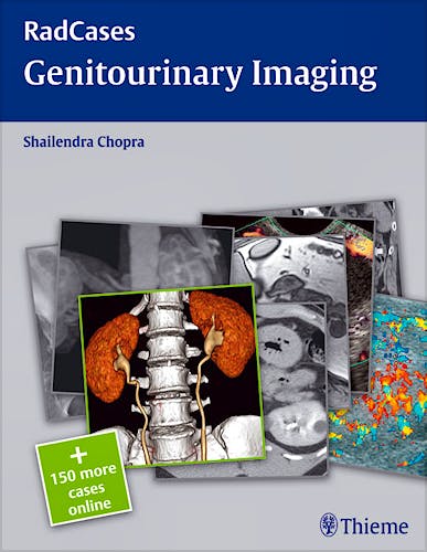 Portada del libro 9781604063240 Genitourinary Imaging (Radcases Series) + 150 More Cases Online