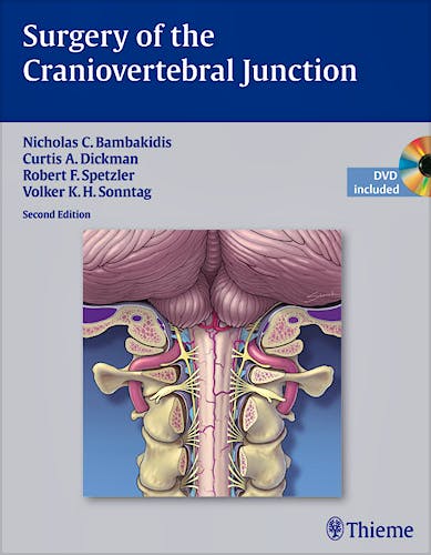 Portada del libro 9781604063387 Surgery of the Craniovertebral Junction