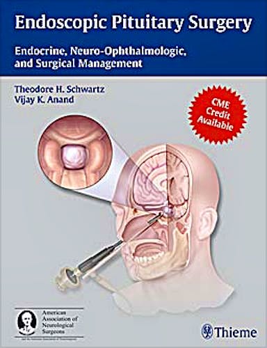 Portada del libro 9781604063479 Endoscopic Pituitary Surgery. Endocrine, Neuro-Ophthalmologic and Surgical Management