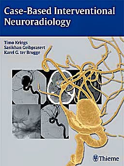 Portada del libro 9781604063738 Case-Based Interventional Neuroradiology