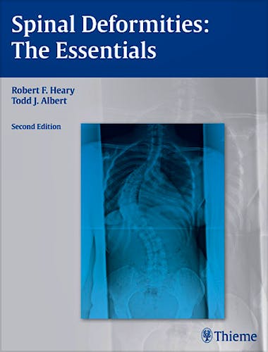 Portada del libro 9781604064117 Spinal Deformities: the Essentials