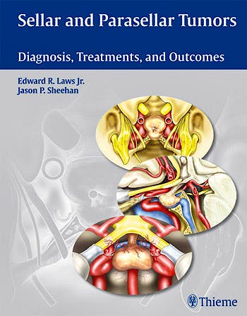 Portada del libro 9781604064216 Sellar and Parasellar Tumors. Diagnosis, Treatments, and Outcomes