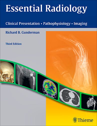 Portada del libro 9781604065732 Essential Radiology. Clinical Presentation, Pathophysiology, Imaging