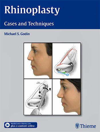 Portada del libro 9781604066807 Rhinoplasty. Cases and Techniques