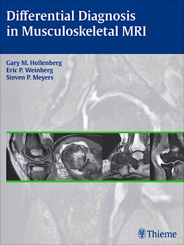Portada del libro 9781604066838 Differential Diagnosis in Musculoskeletal Mri