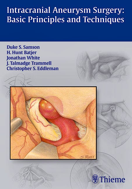 Portada del libro 9781604066937 Intracranial Aneurysm Surgery: Basic Principles and Techniques