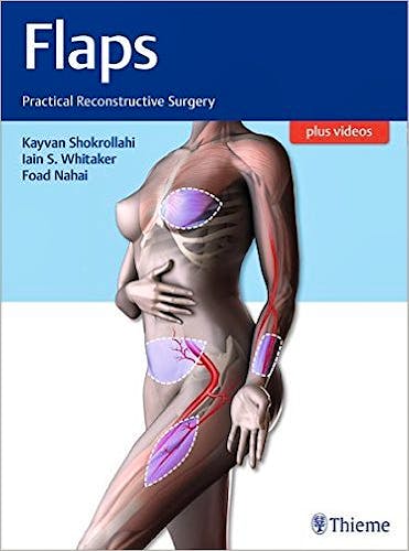 Portada del libro 9781604067156 Flaps. Practical Reconstructive Surgery + Videos Online