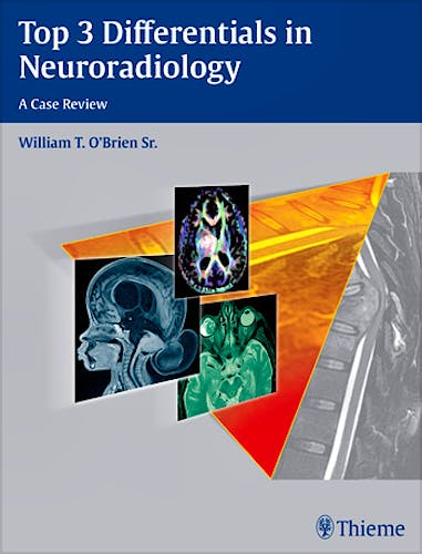 Portada del libro 9781604067231 Top 3 Differentials in Neuroradiology. a Case Review