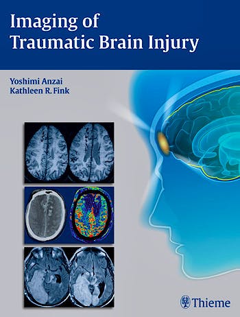 Portada del libro 9781604067286 Imaging of Traumatic Brain Injury