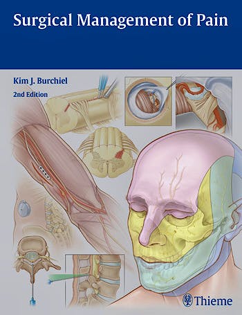 Portada del libro 9781604067514 Surgical Management of Pain