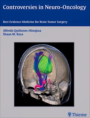 Portada del libro 9781604067552 Controversies in Neuro-Oncology. Best Evidence for Brain Tumor Surgery