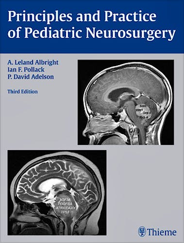 Portada del libro 9781604067996 Principles and Practice of Pediatric Neurosurgery