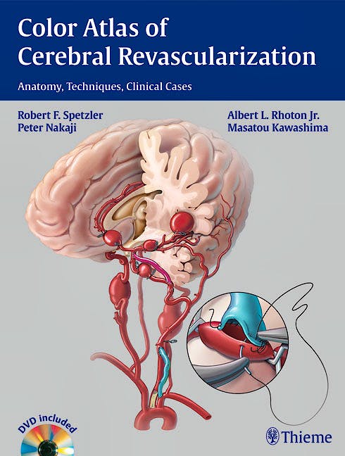 Portada del libro 9781604068221 Color Atlas of Cerebral Revascularization. Anatomy, Techniques, Clinical Cases + Dvd