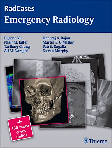 Portada del libro 9781604068320 Emergency Radiology (Radcases Series) + 150 More Cases Online