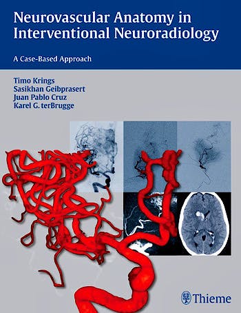 Portada del libro 9781604068399 Neurovascular Anatomy in Interventional Neuroradiology. a Case-Based Approach