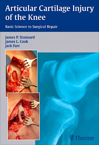 Portada del libro 9781604068580 Articular Cartilage Injury of the Knee. Basic Science to Surgical Repair