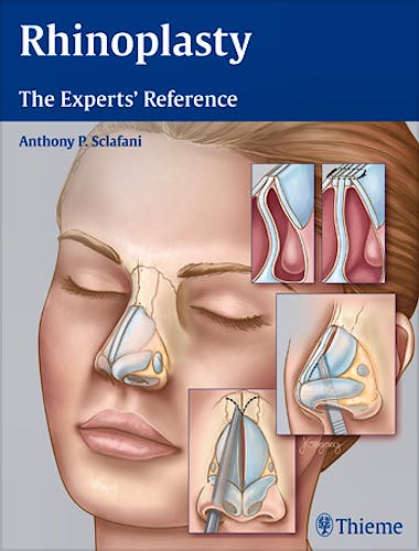 Portada del libro 9781604068672 Rhinoplasty. The Experts' Reference