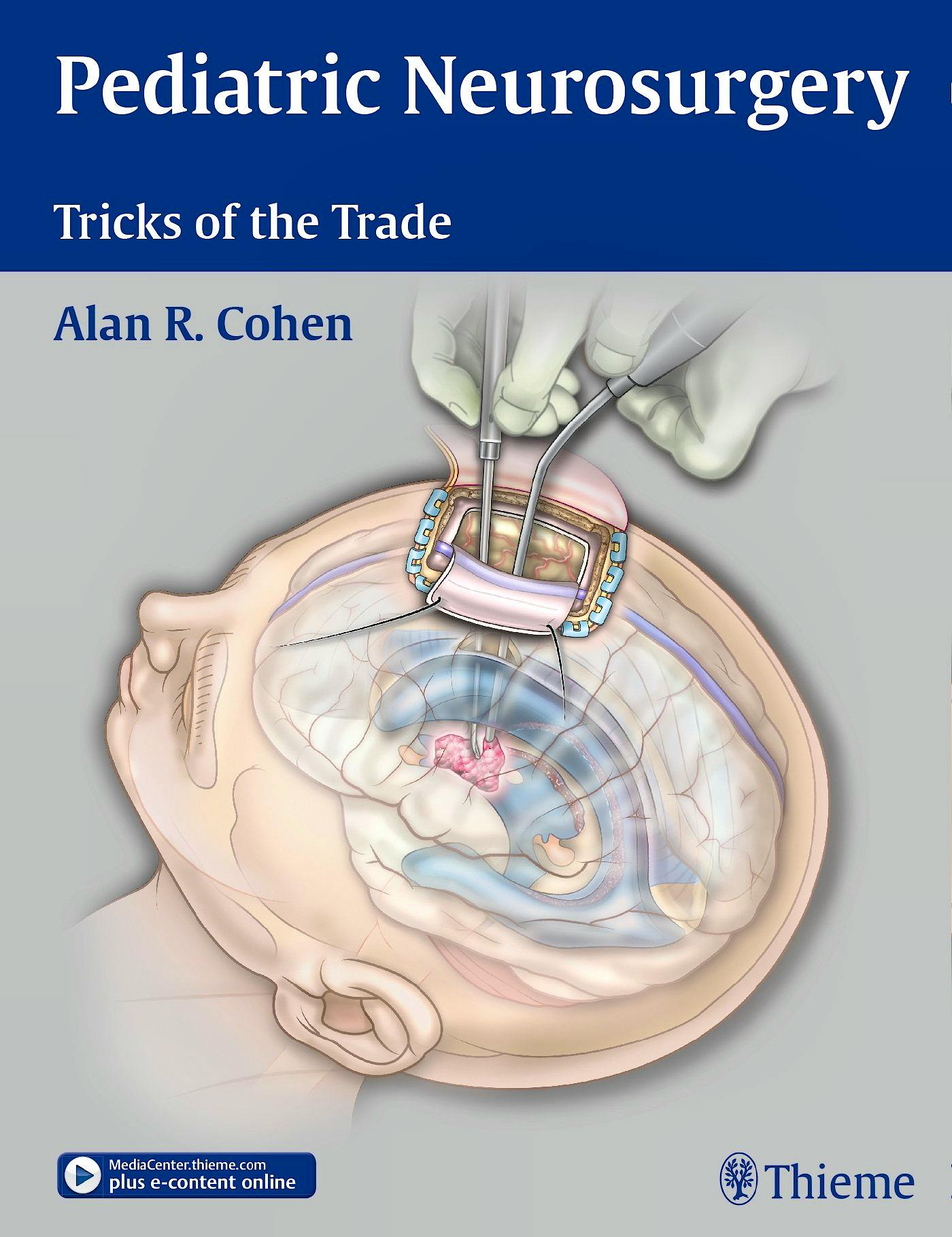 Portada del libro 9781604068696 Pediatric Neurosurgery. Tricks of the Trade